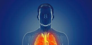 Fibrose kystique (mucoviscidose) : symptômes et traitements Représentation 3D des poumons affectés par la mucoviscidose (fibrose kystique), montrant l'inflammation des voies respiratoires