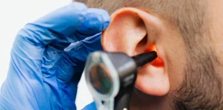 Otite (Otite moyenne) : Symptômes, Causes et Traitement Examen de l'oreille pour diagnostiquer une otite avec un otoscope par un médecin portant des gants en latex, gros plan sur l'examen otoscopique d'un patient pour dépister une otite moyenne aiguë