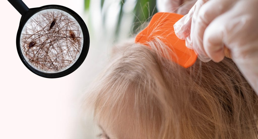 Un professionnel de santé portant des gants blancs peignant les cheveux d’un enfant avec un peigne orange pour détecter les poux de tête, avec une loupe montrant des poux et des cheveux au premier plan, dans un cadre lumineux et propre, illustrant un examen pour les poux de tête.