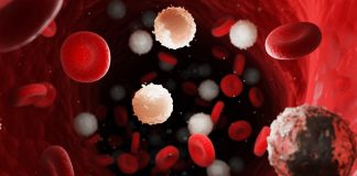 Leucémie – Symptômes, Causes et Options de traitement Cellules sanguines en 3D montrant des globules blancs anormaux et des globules rouges dans un vaisseau sanguin, illustrant la leucémie
